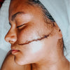 Dermaplaning Treatment